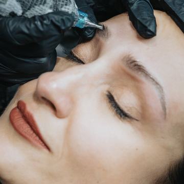 tetovējuma izgaismošana ar removeru procedūras laikā Rīgā