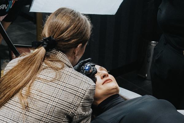 tetovējumu izgaismošana ar removeri process