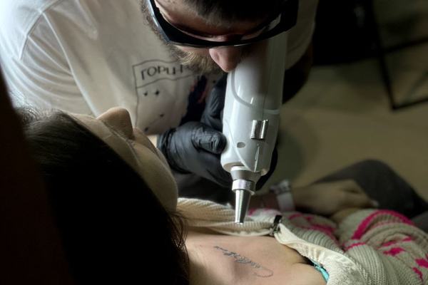 Laser tattoo lightening course