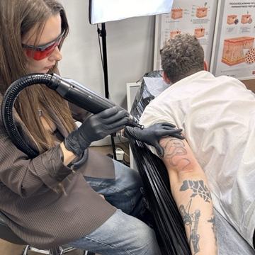Laser tattoo lightening course