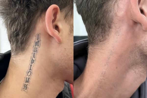 practical session in tattoo lightening course