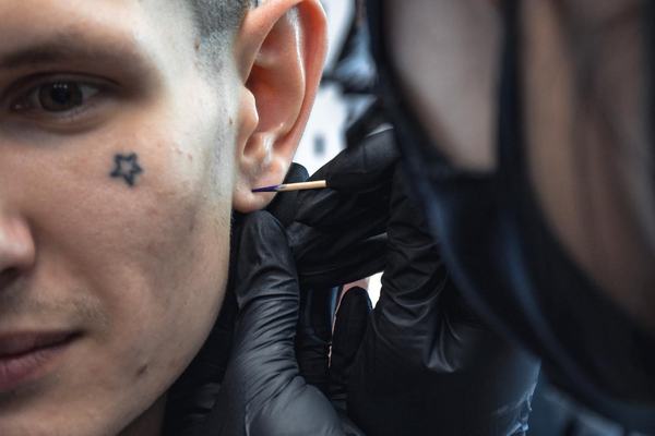 Earlobe piercing procedure